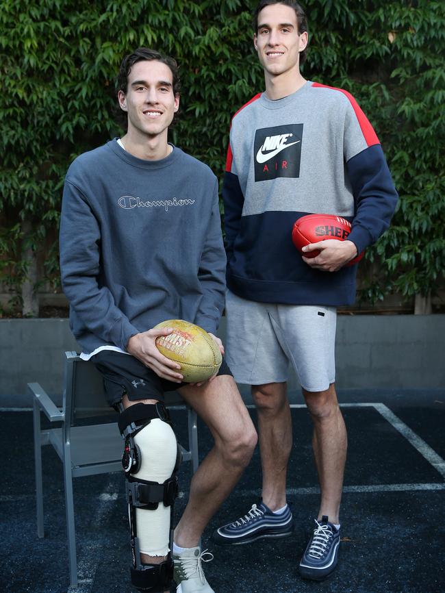 Max King’s knee is now bandaged and in a brace after undergoing a knee reconstruction. Picture: Michael Klein