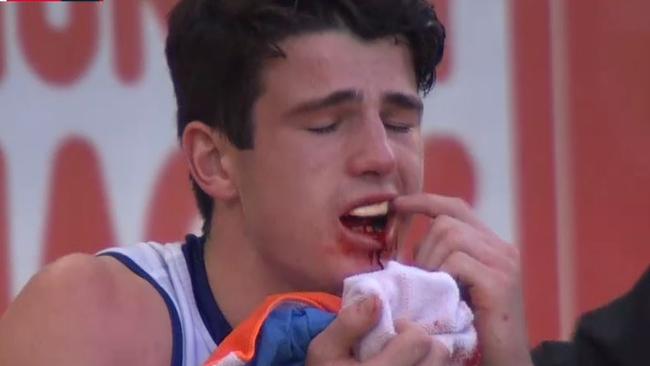 Fremantle Docker Andrew Brayshaw points to his teeth after being hit by Andrew Gaff in Round 20.