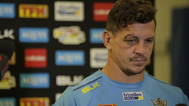 NRL 2016: Greg Bird released by Gold Coast Titans, signs five-year deal  with Catalans