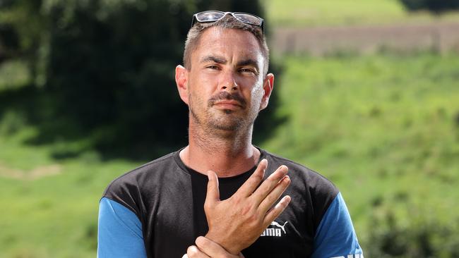 Jay Mobbs, 31, nearly lost his hand in a workplace injury at Toowoomba when it was crushed by a log splitter. Picture: Liam Kidston