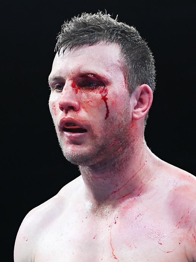 A clash of heads opened up a massive cut over Jeff Horn’s left eye. Picture: Getty Images