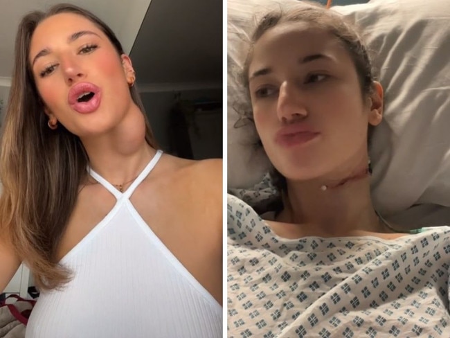 Millions have been warned after a woman shared her scary experience with a massive protrusion on the side of her neck.