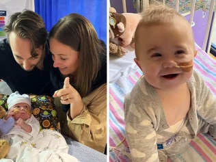 Sydney toddler has the world’s rarest condition