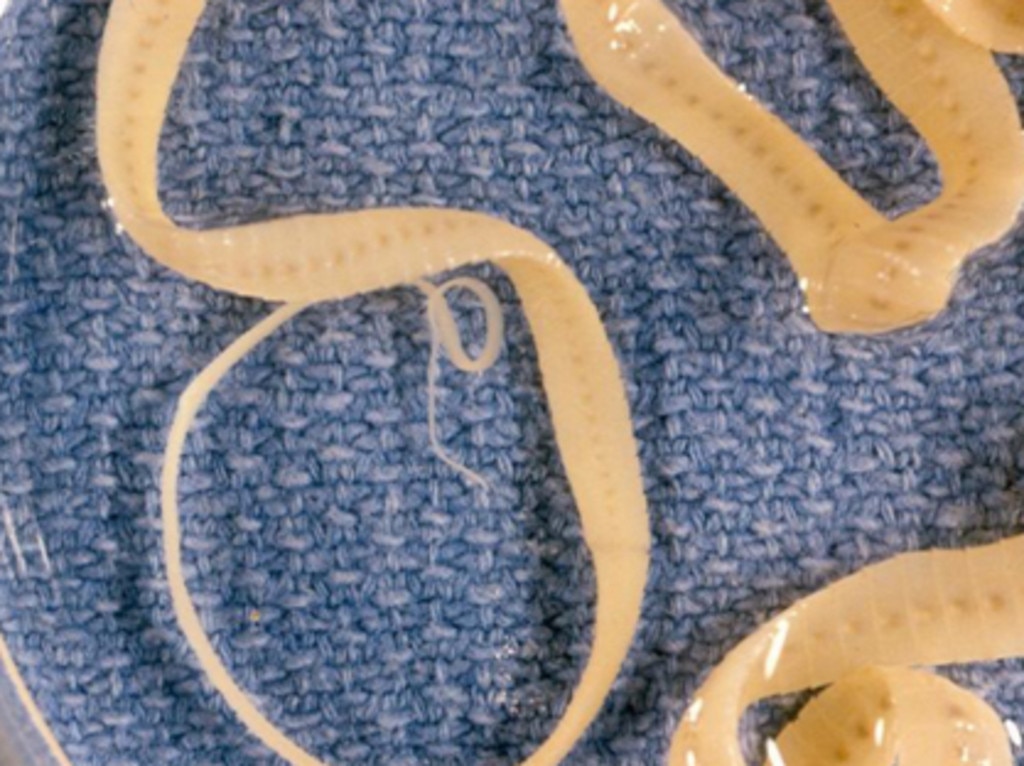 Spirometra tapeworm is just one parasite inside Asian house geckos that Mr Dowell probably ate.