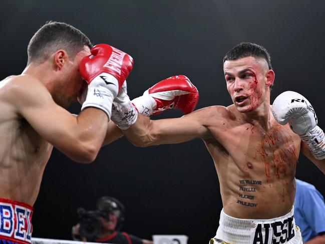 Garside’s eye was split open after a head clash. Pictures: No Limit Boxing/Gregg Porteous