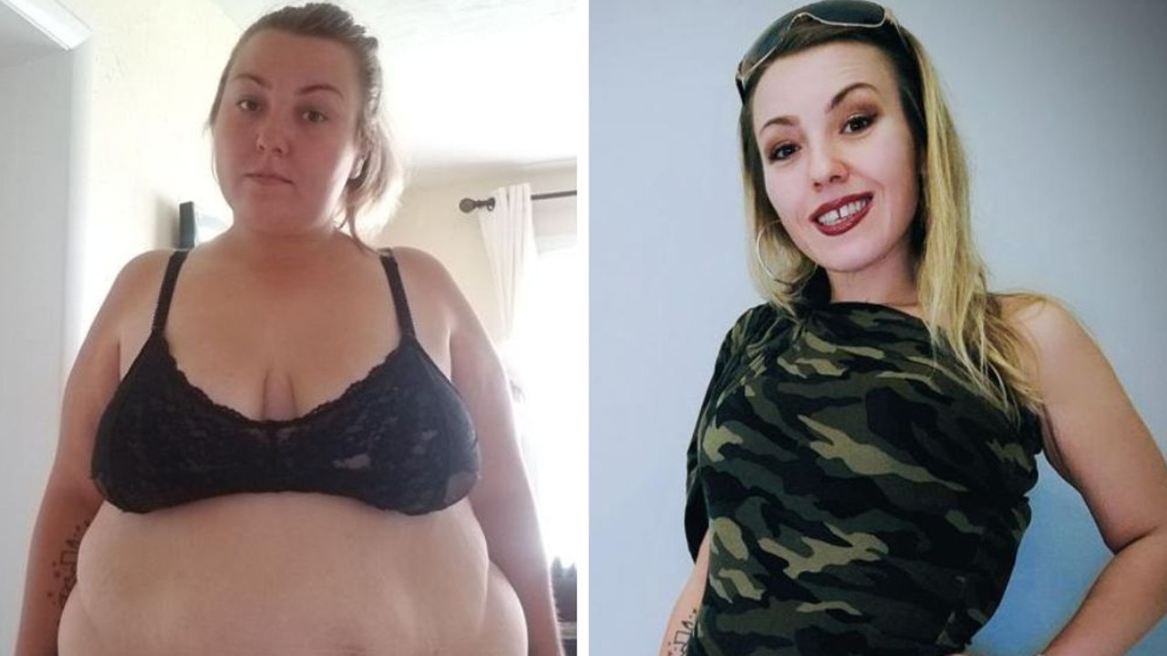 Woman’s sex life ‘ruined’ by 107kg weight loss