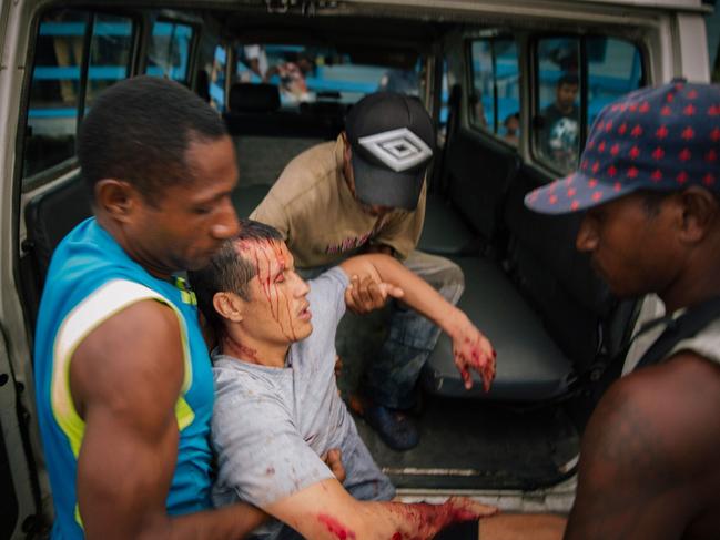 An injured Afghan refugee from the Manus Island detention centre is assisted after he was allegedly attacked by a group of Papua New Guinean men whilst out on a day release in August, 2016.  Picture: AFP Photo/ Matthew Abbott/GETUP 