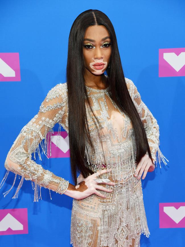 Winnie Harlow. Picture: Getty