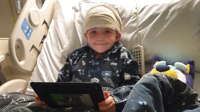 James Selwyn-Smith had a tumour the size of a lemon removed from his brain last year.