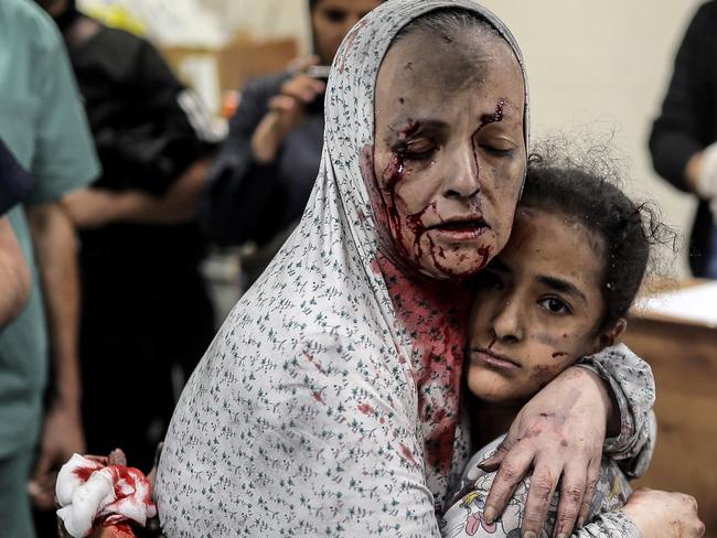 An injured Palestinian woman covered in dust and blood hugs an injured girl child at the hospital following the Israeli bombardment of Khan Yunis, in the southern Gaza Strip, on November 15. Picture: Belal Khaled/AFP