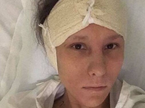 Elena Filipczyk in hospital following surgery on her ear. Picture: Supplied