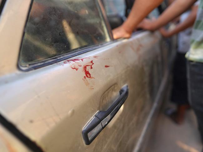 Palestinians rush to the aid of a man, wounded after an Israeli strike, near the the Nasser Medical Complex in Khan Yunis in the southern Gaza Strip on August 26, 2024. Picture: AFP