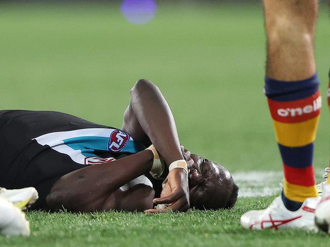 Aliir showed ‘clear signs of concussion’ in head knock: Expert