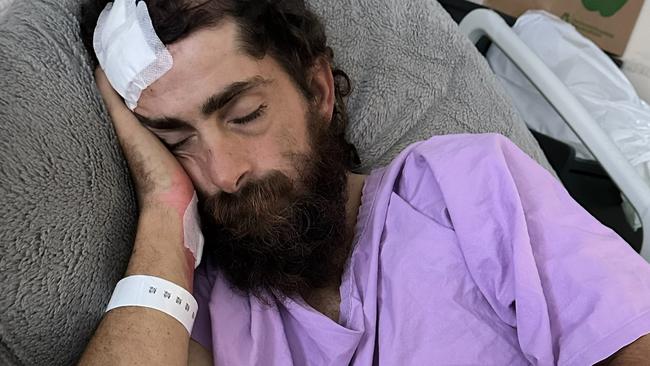 Young man’s warning as eye check leads to sinister tumour discovery
