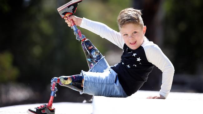 Ted gets his new legs at the Royal Children's Hospital. Picture: Alex Coppel.