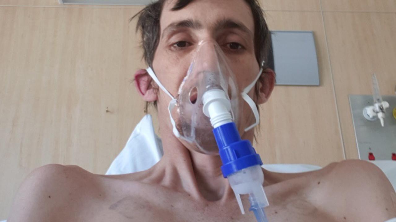 Anthony White, 36, needs a double lung transplant after being diagnosed with silicosis. An audit of 10 manufacturers of engineered stone benchtops in Queensland uncovered 26 cases of silicosis, six of which are terminal . Picture by Luke Marsden.