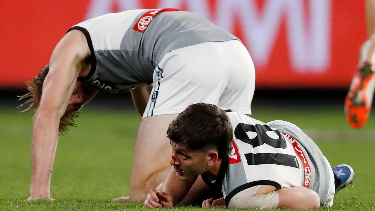 It was a terrible moment between Butters and Jonas. Photo by Dylan Burns/AFL Photos via Getty Images