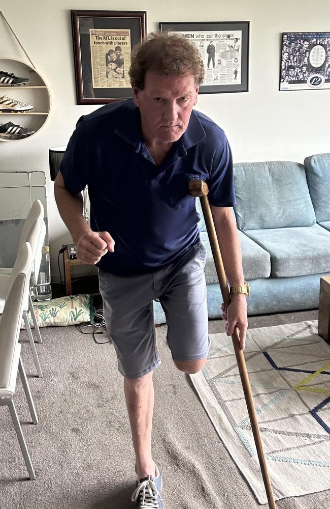 Ricky Nixon is training with a crutch for his acting debut as an amputee gangster.