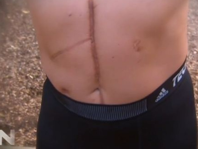 Chris Soteriou shows the scars from the attack: Sunday Night