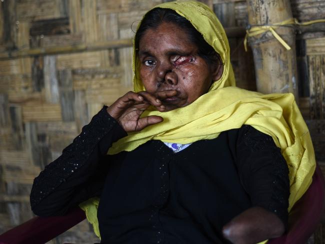 Rohingya refugee Juhara, whose name has been changed to protect her identity, ran for her life but was hunted down and attacked. Her husband and parents were killed. Picture: Nick Perry/AFP