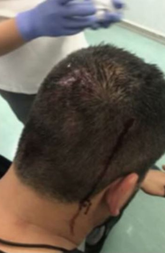 This photo appears to show a passenger on the Carnival Legend being treated for a cut to the head. Picture: 3AW