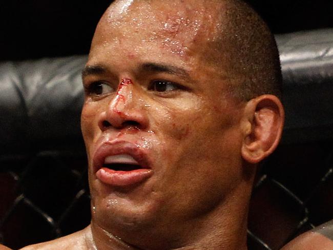 LAS VEGAS, NV - JANUARY 03: Hector Lombard is shown following a three-round welterweight fight against Josh Burkman (R) during the UFC 182 event in the MGM Grand Garden Arena on January 3, 2015 in Las Vegas, Nevada. Lombard won by unanimous decision. (Photo by Steve Marcus/Getty Images)