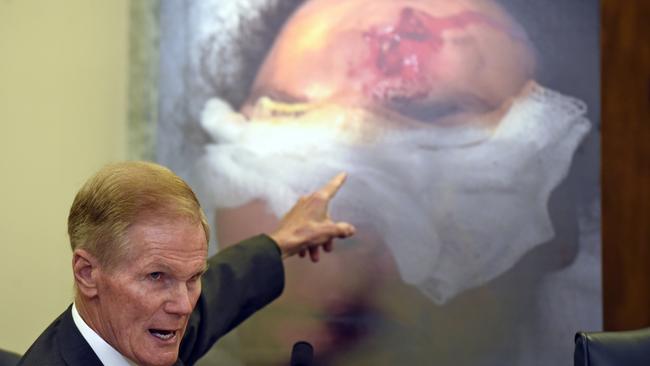 In 2015, US Senator Bill Nelson points to the injury on a victim who was hit by shrapnel when a car's Takata airbag inflated. Picture: AP Photo/Susan Walsh