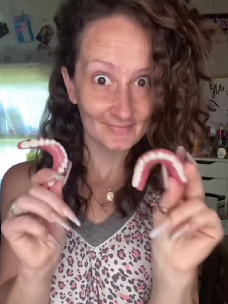 Toothless Mum Shows Off Incredible False Teeth Transformation Photos The Cairns Post