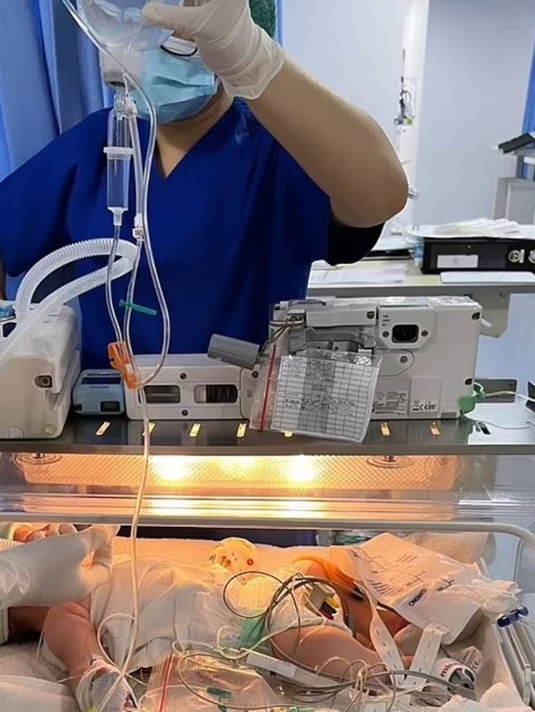 The baby has a severe bacterial infection and now requires a ventilator to breathe. Picture: Instagram / Honey Ahimsa