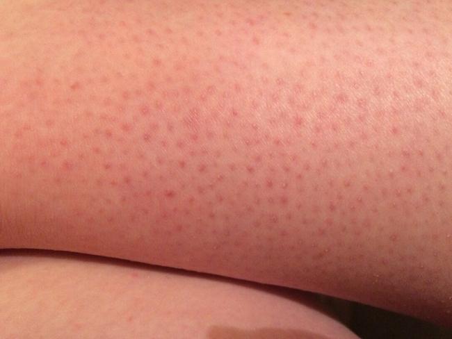 The reason behind these little red dots will gross you out.