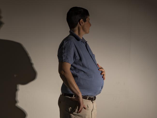 ‘Call me dad’: Pregnant man takes birth drama to court