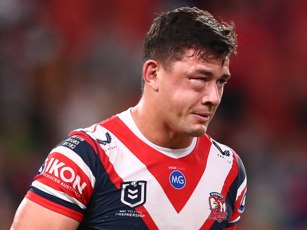 Joey Manu suffered a fractured cheekbone. Photo by Chris Hyde/Getty Images