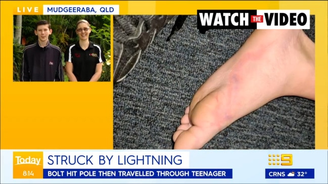 Gold Coast teenager miraculously survives lightning strike