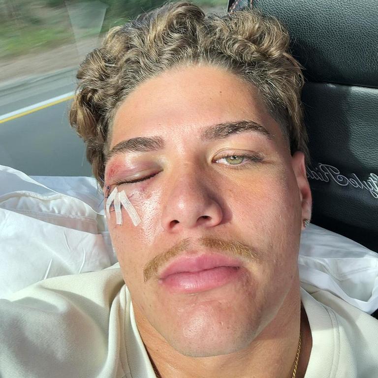 Injured Broncos star Reece Walsh relaxes aboard the Walsh Express on his way back to Brisbane. Picture: Instagram