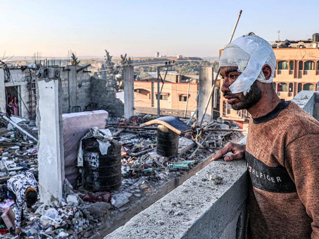 An injured man with a bandaged head looks on while standing next to the rubble and debris of a destroyed building in the aftermath of Israeli bombardment on Rafah. Picture: AFP