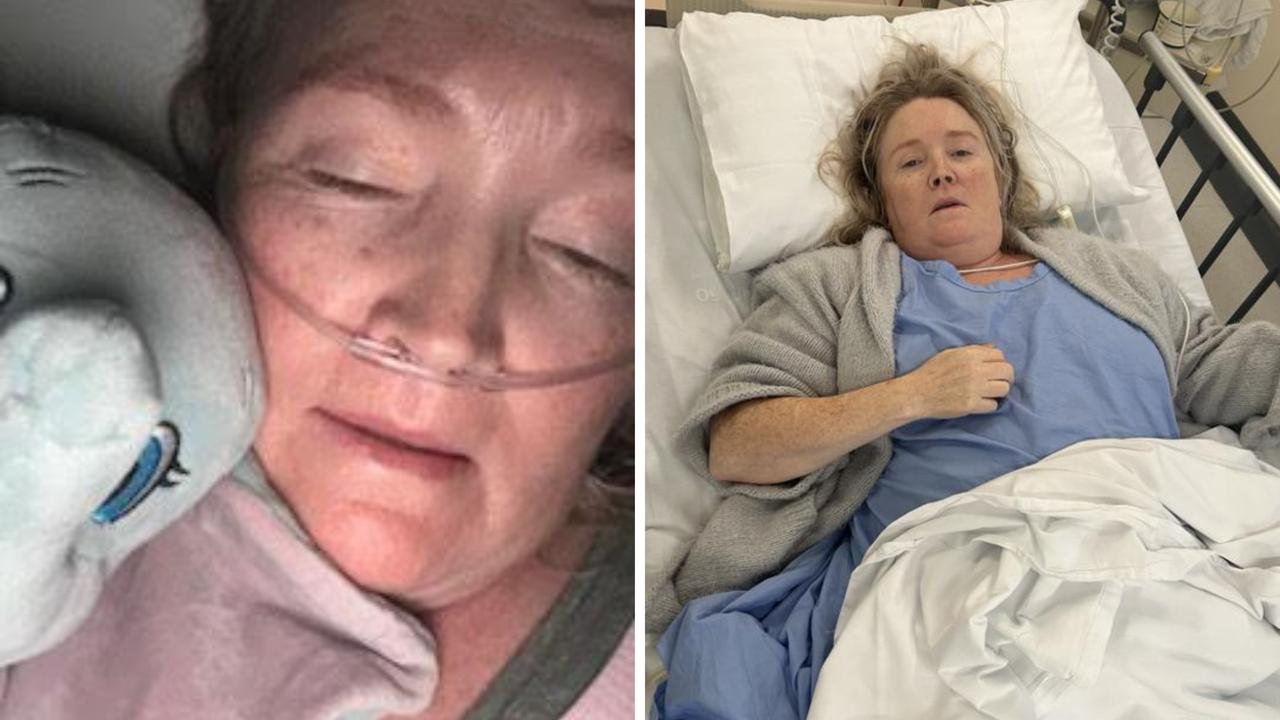 50yo nearly died after ‘simple’ surgery