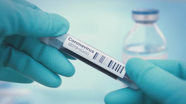 More than 35 people have tested positive to COVID-19 in the Frankston region.