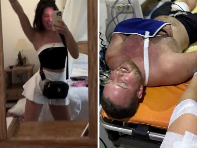Mrs Van Voorst was on crutches after the accident. Picture: Instagram.