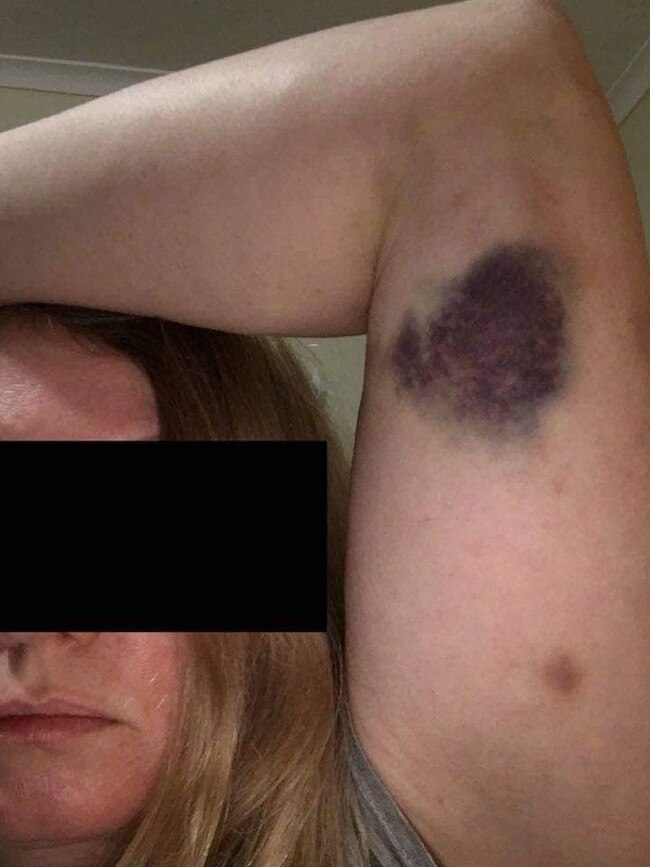 Images of a woman who alleges she was assaulted by police while being arrested for breaching COVID-19 restrictions. Picture: Facebook.