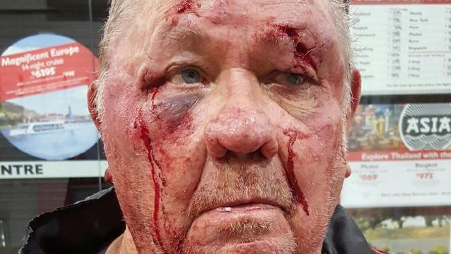 Police are appealing for public assistance after an elderly man was injured during a robbery in Sydney’s south-west. About 5.45am today (Sunday 21 February 2016), a 76-year-old man was walking on the footpath of Chester Hill Road, Bass Hill, when he was accosted by a man who pushed him into a fence. The man then punched him in the face, causing him to fall to the ground. He was then punched in the face numerous times again. The offender removed the man’s wallet and took out some cash out before leaving the scene. Photo courtesy of NSW Police