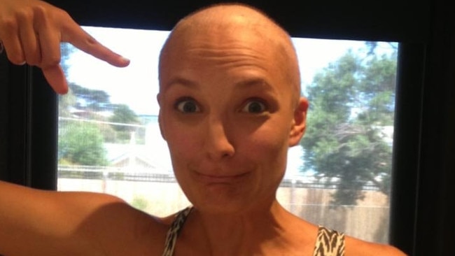 Emily after she lost her hair. Picture: Supplied