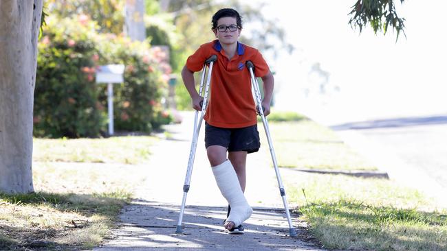 Aidan Clonan is recovering well after he was mauled by a dog while walking back from basketball training in Diamond Creek last week. Picture: George Salpigtidis