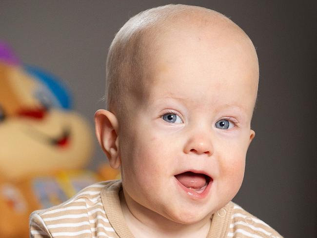 MELBOURNE, JUNE 24, 2024: Teddy Kirby, 15 months. Teddy weighed as much as a glass of milk when he was born. Entering the world at 26 weeksÃ gestation he weighed just 719 grams and could almost fit in his motherÃs hand. Picture: Mark Stewart