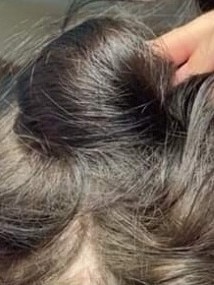 Her hair was seriously damaged by the product. Picture: GoFundMe