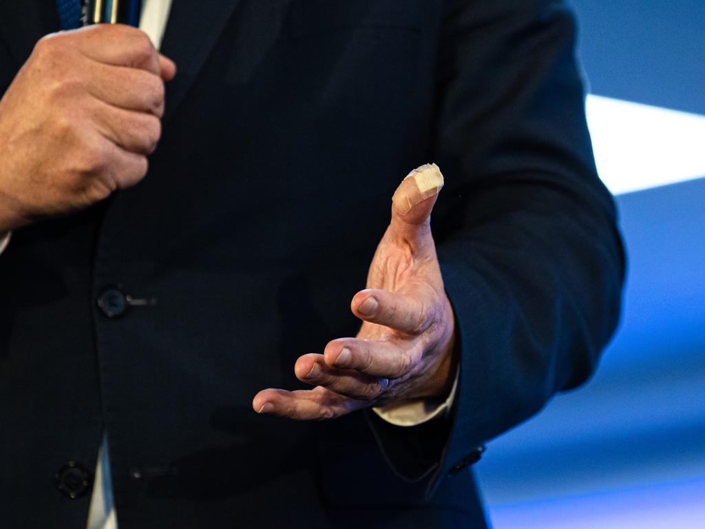 Scott Morrison’s thumb was a victim of his cooking. Picture: Jason Edwards