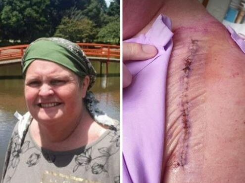 A Kingaroy mum of five, whose stage four cancer and brain tumor went undetected for months by doctors, is urging women to normalise ‘life saving’ check ups.