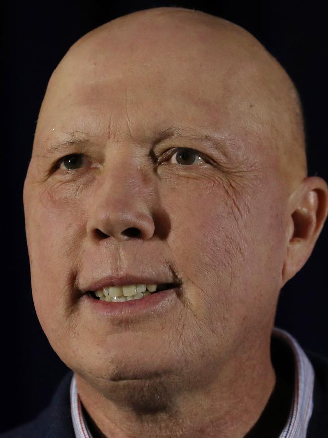 Peter Dutton has revealed he has alopecia. Picture: Zak Simmonds