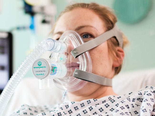 TOPSHOT - An undated handout image released by University College London (UCL) in London and received on March 30, 2020, shows a volunteer patient posing whilst wearing the Continuous Positive Airway Pressure (CPAP) breathing aid, developed in less than a week by mechanical engineers, doctors and the Mercedes Formula 1 team in conjunction with UCL. - Medical researchers and engineers at UCL have teamed up with Formula One outfit Mercedes to adapt a breathing aid for mass production that could keep coronavirus patients off much-needed ventilators.  University College London said UK regulators had approved its adaptation of the continuous positive airway pressure device (CPAP), which helps patients with breathing difficulties. A version of the equipment, which increases air and oxygen flow into the lungs, has already been used in hospitals in Italy and China to help COVID-19 patients with serious lung infections. (Photo by James Tye / University College London (UCL) / AFP) / RESTRICTED TO EDITORIAL USE - MANDATORY CREDIT "AFP PHOTO / James Tye/ UCL / Handout " - NO MARKETING - NO ADVERTISING CAMPAIGNS - DISTRIBUTED AS A SERVICE TO CLIENTS