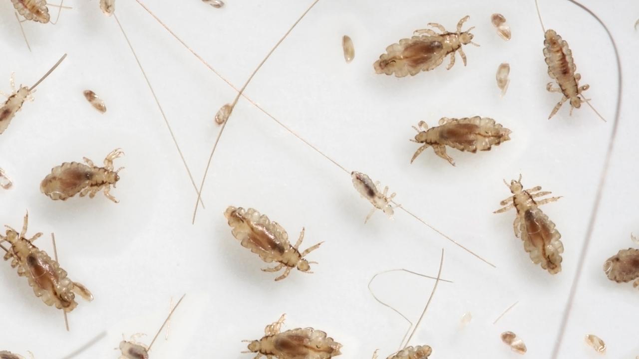 A toddler suffered a lice infestation for more than a month, leading to her mother being charged with child cruelty. Istock image