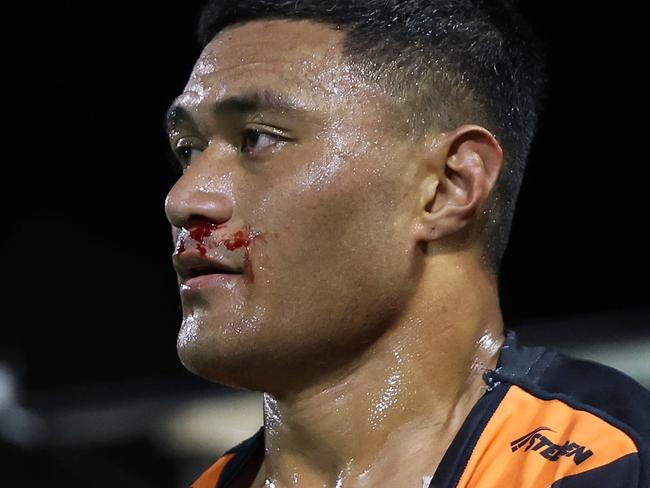 SYDNEY, AUSTRALIA - JULY 06: Stefano Utoikamanu of the Wests Tigers leaves the fiels with a bloody nose and ripped shirt during the round 18 NRL match between Wests Tigers and Melbourne Storm at Leichhardt Oval, on July 06, 2024, in Sydney, Australia. (Photo by Scott Gardiner/Getty Images)